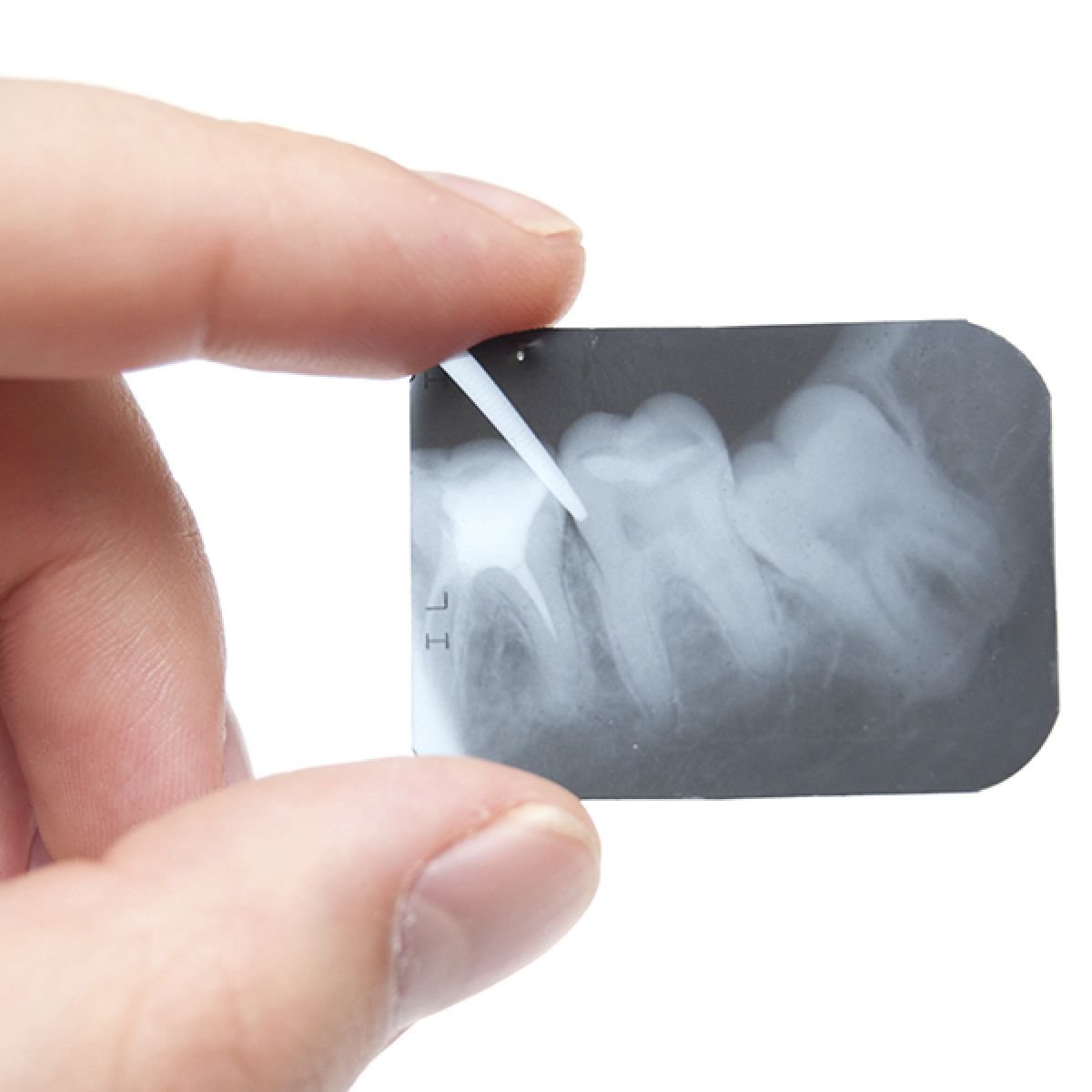 Implantologia dentale Travaglini Viterbo